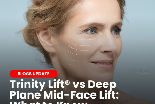 Minimally Invasive Facelift