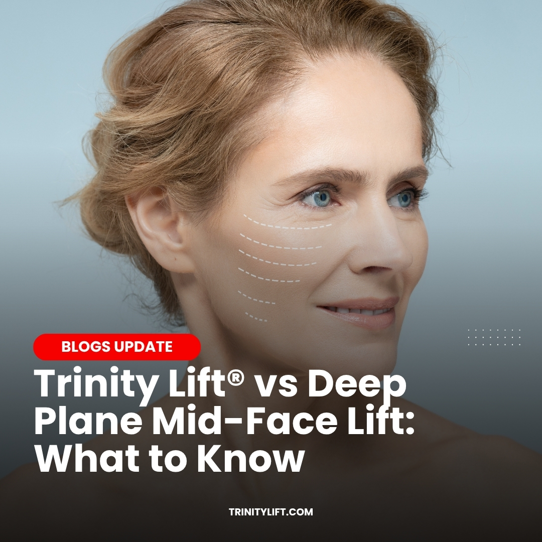 Minimally Invasive Facelift