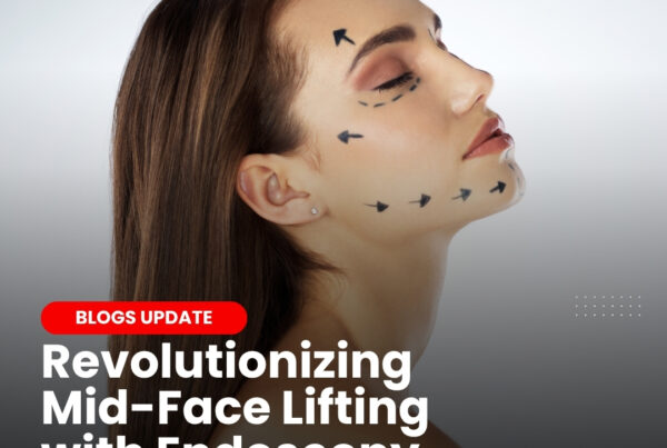 Trinity Lift longevity