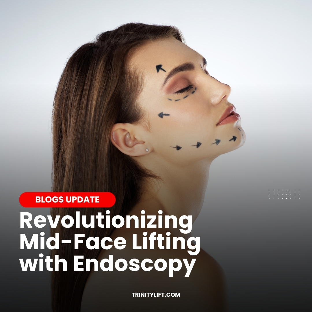 Mid-Face Rejuvenation Surgery