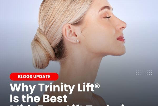 Trinity Lift detailed explanation