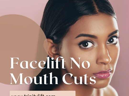 Facelift No Mouth Cuts