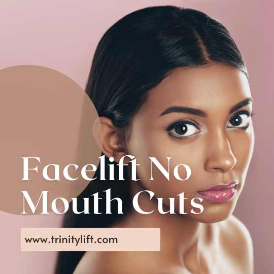 Facelift No Mouth Cuts