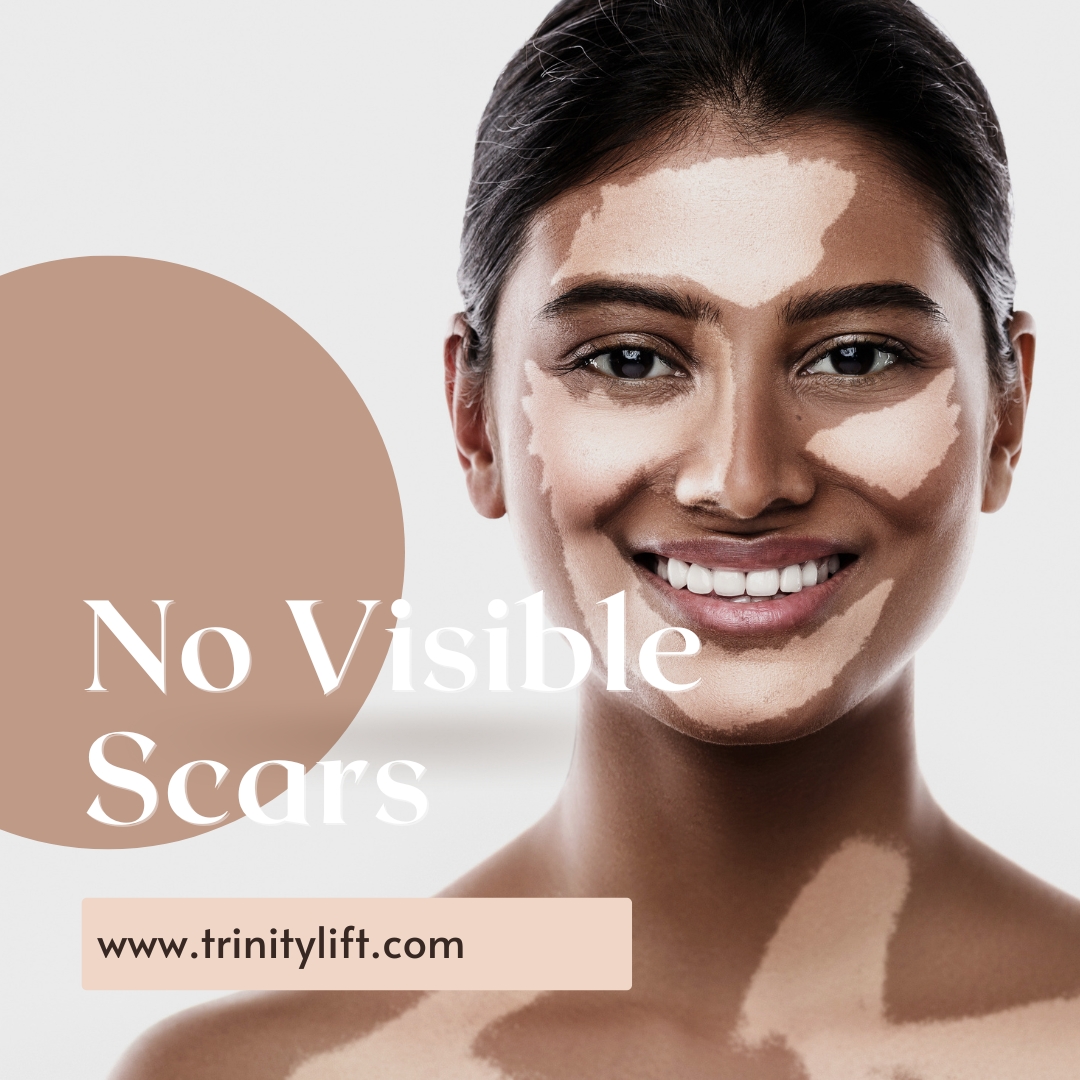 No Visible Scars