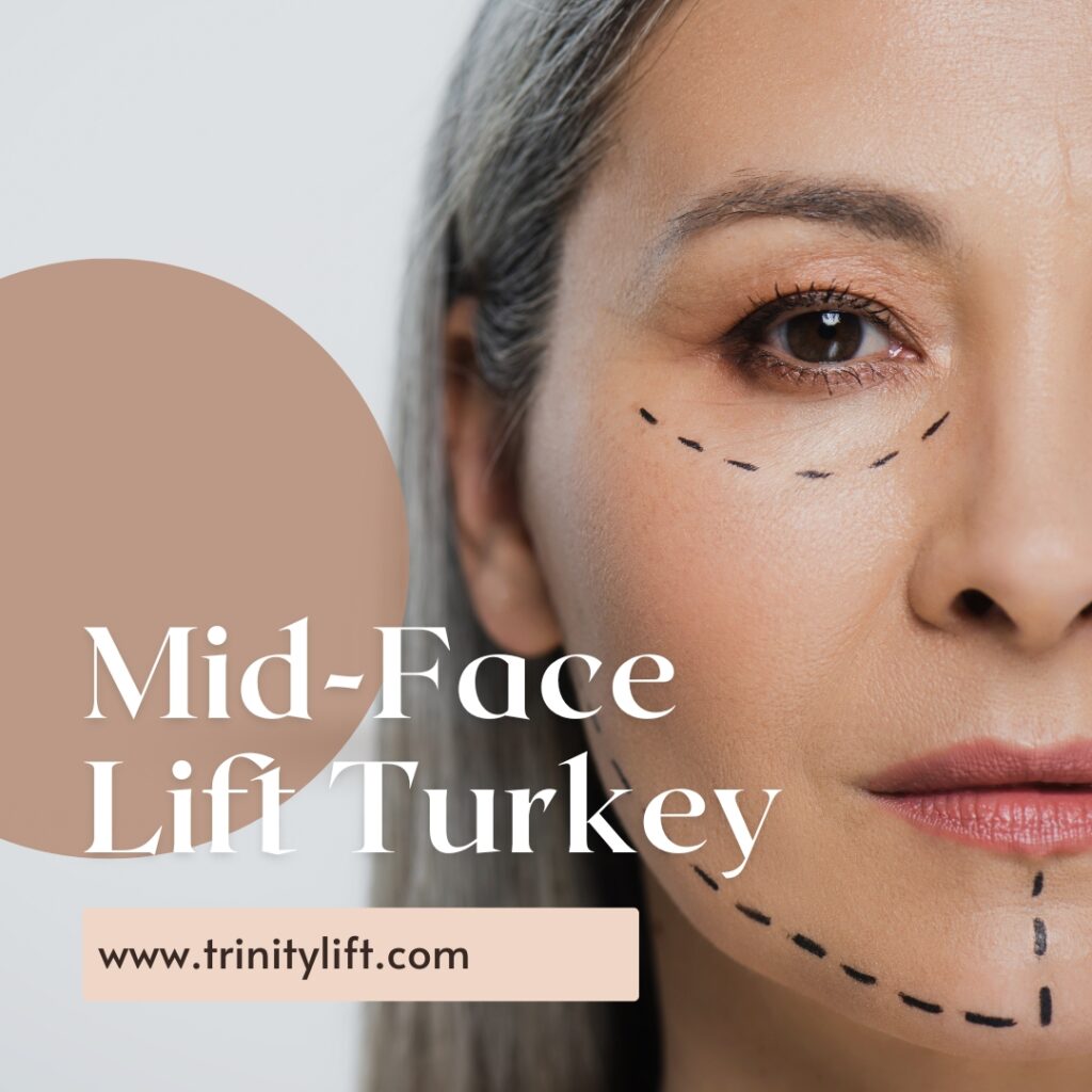 Mid-face Lift Turkey