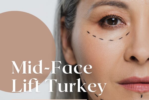 Mid-face Lift Turkey