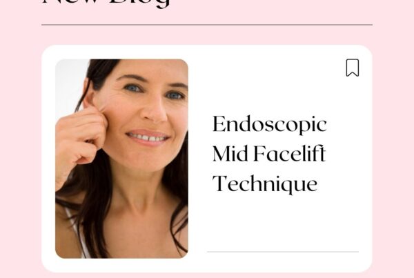 Endoscopic Mid Facelift Technique