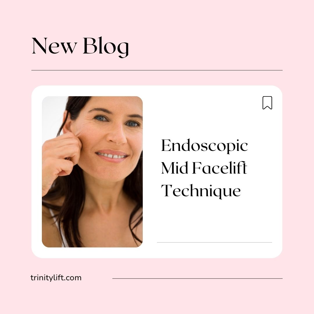 Endoscopic Mid Facelift Technique
