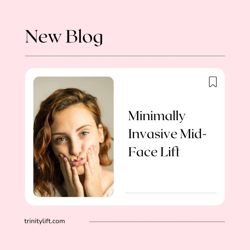 Minimally Invasive Mid-Face Lift